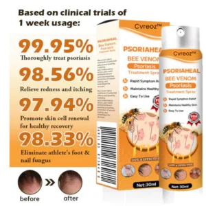 Cvreoz™ PsoriaHeal Bee Venom Psoriasis Treatment Spray