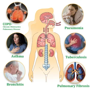 Official Store-Raindew™ Herbal Lung Cleansing Inhaler