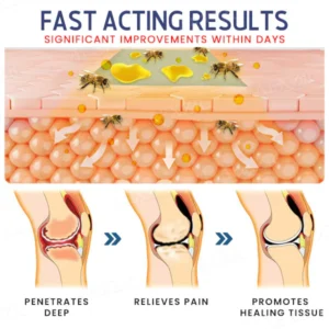 Dobshow™ BeeVenom Joint & Bones Care