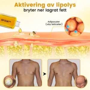 GFOUK™ ThermoFirm Bee Venom Gynecomastia Oil