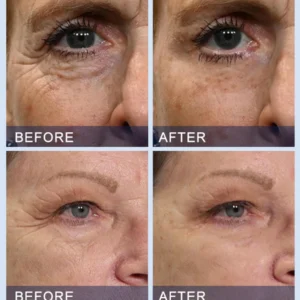 Furzero™ All-in-One Lifting & Firming Serum Smooths