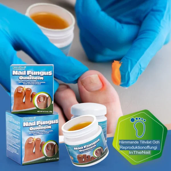 Fast-Acting Antifungal Nail Ointment