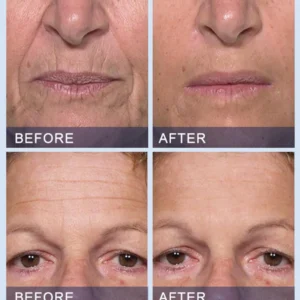 Furzero™ All-in-One Lifting & Firming Serum Smooths