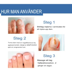 Fast-Acting Antifungal Nail Ointment