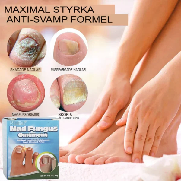 Fast-Acting Antifungal Nail Ointment
