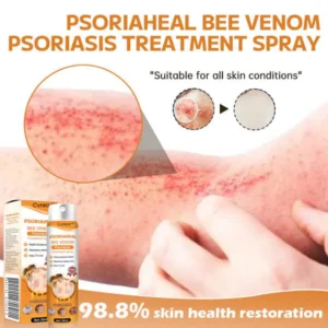 Cvreoz™ PsoriaHeal Bee Venom Psoriasis Treatment Spray
