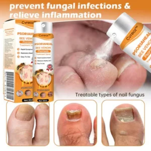 Cvreoz™ PsoriaHeal Bee Venom Psoriasis Treatment Spray