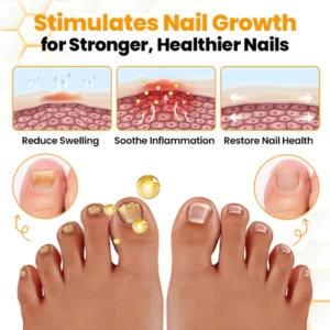 Biancat™ BeeVenom Anti-Fungal Nail Renewal Oil