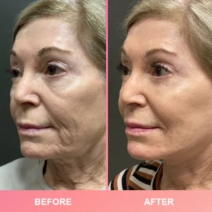 LIMETOW™ Wrinkle Bounce Multi Balm