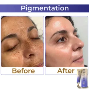 flysmus™ Collagen+ Bee Venom Roller Eye Cream