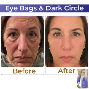 flysmus™ Collagen+ Bee Venom Roller Eye Cream