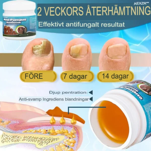 Fast-Acting Antifungal Nail Ointment