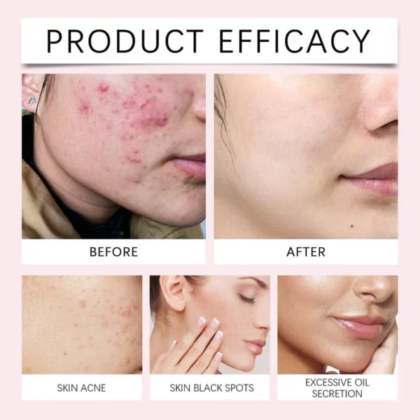 Aprolo™ Turmeric & Kojic Acid Pads
