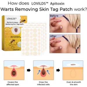 LOVILDS™ Apitoxin Warts Removing Skin Tag Patch
