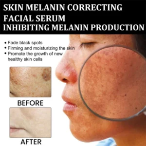 JEREMYTIS™ Vitamin C Spot Brightening Serum