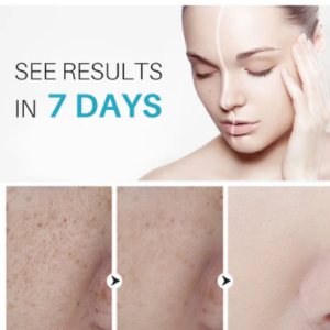 Lanthome Dark Spot Corrector & Remover