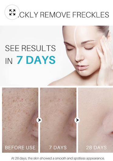 Lanthome Dark Spot Corrector & Remover