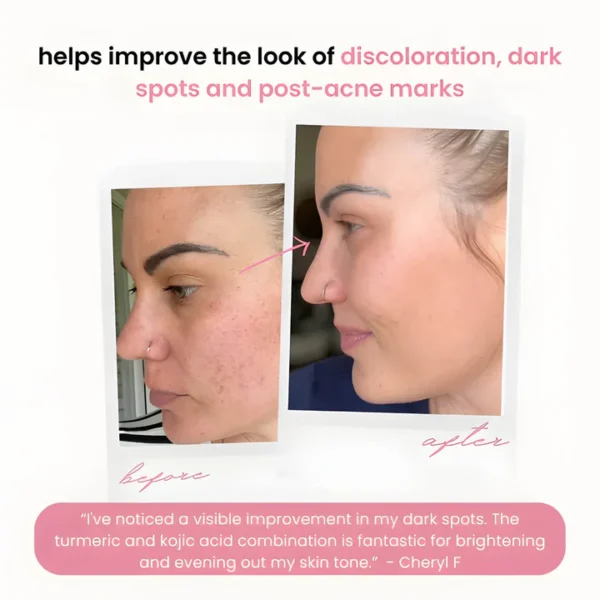 Aprolo™ Turmeric & Kojic Acid Pads