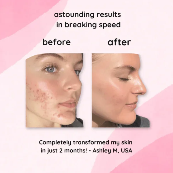 Aprolo™ Turmeric & Kojic Acid Pads