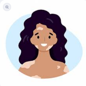 Fivfivgo™ BeeVenom Vitiligo ( 7 Days Result ) Treatment Cream